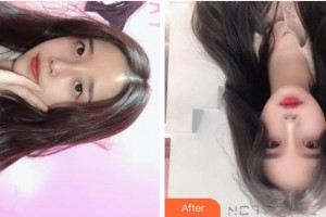 上海玫瑰醫(yī)療美容醫(yī)院刁慶華整形價(jià)格表附微針美膚案例展示