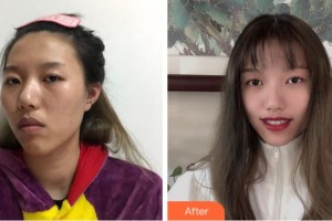 上海玫瑰醫(yī)療美容醫(yī)院汪梅主診醫(yī)師整形價(jià)格表附白瓷案例展示