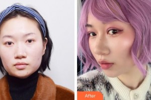 上海藝星醫(yī)療美容醫(yī)院裴宰瑩整形價格表附埋線雙眼皮+去脂案例展示