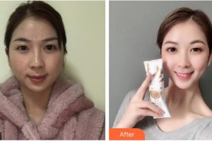 上海藝星醫(yī)療美容醫(yī)院宗建華整形價格表附[激光美膚祛斑]多方面部激光美膚祛斑案例展示