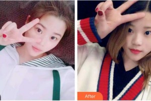 上海藝星醫(yī)療美容醫(yī)院李榮權(quán)整形價格表附冷光美白案例展示