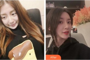 上海比華利整形醫(yī)院劉姝娟主治醫(yī)生整形價格表附鼻修復+鼻部手術案例展示