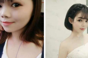 南京東美整形美容醫(yī)院嚴(yán)東玲整形價(jià)格表附無針?biāo)獍咐故?>
</a>
<h3 class=