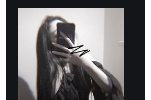 南京維多利亞整形美容醫(yī)院Eric.Redd整形價(jià)格表附V-LINE瓜子瘦臉手術(shù)案例展示