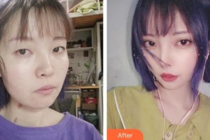 上海瑞麗整形美容醫(yī)院安健榮整形價格表附【水氧活膚】皮膚清潔補水嫩膚案例展示