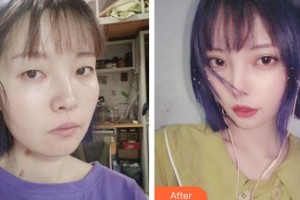 上?，旣愥t(yī)院整形美容中心李云天主診醫(yī)師整形價格表附皮膚清潔補水嫩膚案例展示