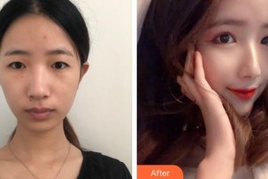 上海第二軍醫(yī)大學附屬長征醫(yī)院整形外科章建林整形價格表附桃花美眼案例展示