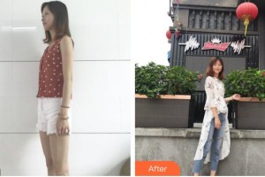 上海市第七人民醫(yī)院燒傷整形科吳志宏整形價格表附燙傷疤痕案例展示