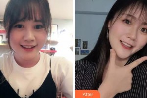 上海顏夢醫(yī)療美容門診部楊璐整形價格表附眼部手術案例展示