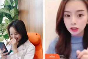 上海原辰醫(yī)療美容醫(yī)院梁在鎮(zhèn)整形價格表附面部吸脂案例展示