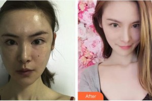 上海天大醫(yī)療美容醫(yī)院高榮敏整形價格表附【抗衰嫩膚】案例展示