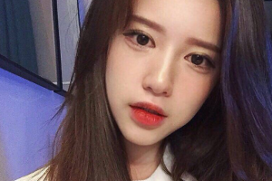 南京鳳凰島整形美容醫(yī)院王影整形價(jià)格表附眼部綜合案例展示