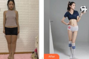 上海第三軍醫(yī)大學大坪醫(yī)院醫(yī)學美容中心楊西川整形價格表附吸脂瘦大腿案例展示