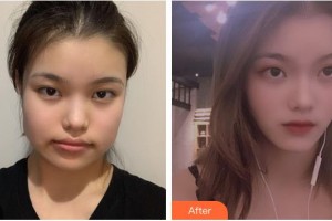 上海百達(dá)麗醫(yī)療美容醫(yī)院王維整形價(jià)格表附自然V臉型案例展示