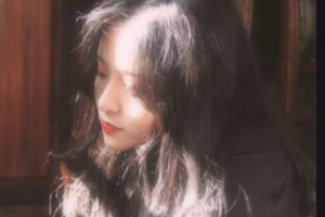 南京繆斯女神醫(yī)療美容診所許更宇整形價格表附假體墊眉弓案例展示