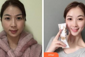 上海伯思立醫(yī)療美容門診部馬文容整形價(jià)格表附多方面部激光美膚祛斑案例展示