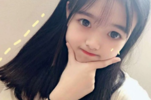 南京美好尉來整形美容診所孫露整形價格表附面部吸脂案例展示