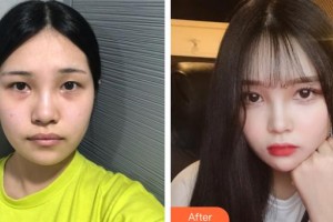 上海新健威醫(yī)療美容門診部錢成寶整形價(jià)格表附頜面整形案例展示