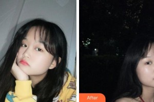 武警上海總隊(duì)醫(yī)院整形美容中心朱麗倩整形價(jià)格表附光子嫩膚案例展示