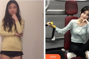 上海港華醫(yī)療美容醫(yī)院整形價(jià)格表附自體脂肪豐胸案例展示