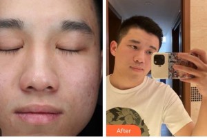 上海二醫(yī)大附屬第九人民醫(yī)院整形激光美容中心劉健航整形價格表附皮膚管理案例展示