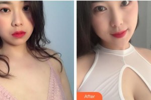 上海奉浦醫(yī)療美容醫(yī)院安群整形價格表附胸部整形案例展示