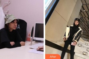 上海歐華醫(yī)療美容門診部樸麗華整形價格表附皮膚管理案例展示