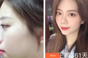 上海伊萊美醫(yī)療美容醫(yī)院王海鑫整形價格表附牙齒矯正案例展示