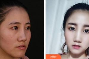 上海伊萊美醫(yī)療美容醫(yī)院任建新整形價格表附皮膚管理案例展示