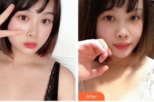 上海伊萊美醫(yī)療美容醫(yī)院張余光整形價格表附胸部整形案例展示