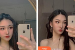 上海市皮膚病醫(yī)院醫(yī)療美容科徐曉云整形價格表附皮膚管理案例展示