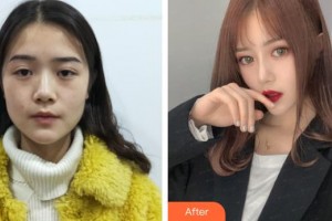 上海凱渥醫(yī)療美容門診部陳小萱整形價格表附美鼻部手術(shù)案例展示