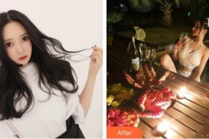 上海歐邦醫(yī)療美容門診部史緋緋整形價(jià)格表附埋線雙眼皮案例展示