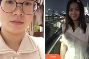 上海薇琳醫(yī)療美容門診部黃敬夏整形價(jià)格表附溶脂案例展示