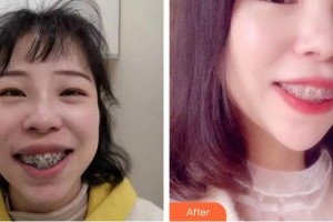 醫(yī)療美容門(mén)診部魏東整形價(jià)格表附牙綜合案例展示