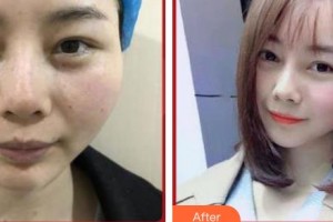 上海百達(dá)麗醫(yī)療美容醫(yī)院梁東民整形價(jià)格表附祛斑案例展示