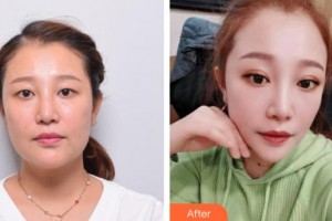 上海伊萊美醫(yī)療美容醫(yī)院馬曉鴿整形價(jià)格表附皮膚管理案例展示