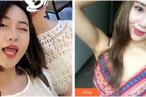 上海雅悅口腔門診部黃潔整形價(jià)格表附全隱形牙齒矯正案例展示