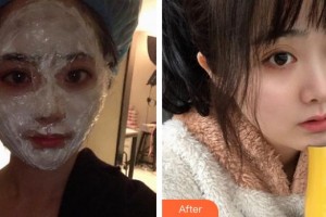 上海迪寇醫(yī)療美容門診部高中玉整形價(jià)格表附四代熱瑪吉案例展示