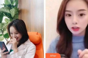 上海維樂口腔門診部翟建博整形價(jià)格表附超聲波潔牙案例展示