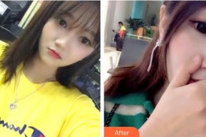 上海拜博昌仁口腔門(mén)診部魏兵整形價(jià)格表附超聲波潔牙案例展示