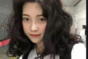 南京愛微醫(yī)療美容門診部姜冬寧整形價(jià)格表附玻尿酸精華導(dǎo)入案例展示