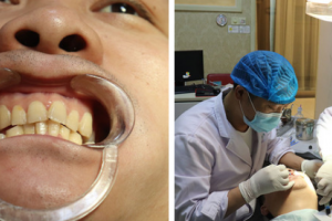 南京智顏醫(yī)療美容門診部高仲岳整形價(jià)格表附激光祛斑案例展示