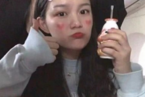 南京愛爾眼科醫(yī)院陳緒攀整形價(jià)格表附眼部綜合案例展示