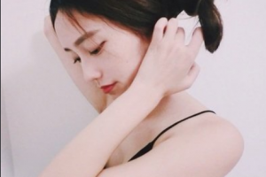 南京醫(yī)科大學(xué)眼科醫(yī)院王新娥整形價(jià)格表附眶隔脂肪釋放案例展示