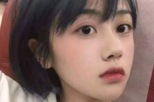 南京醫(yī)科大學(xué)眼科醫(yī)院孫光麗整形價(jià)格表附切開雙眼皮案例展示