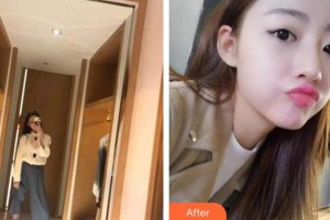 上海麗鉑醫(yī)療美容門診部下村伸二整形價格表附牙齒矯正案例展示