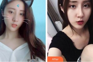 上海柏薈醫(yī)療美容門診部王昭欽整形價(jià)格表附激光美膚激光祛斑案例展示