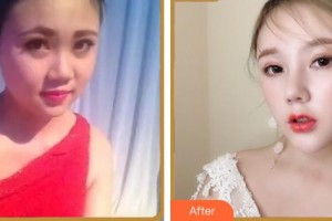 成都市第三人民醫(yī)院醫(yī)學(xué)整形美容科王俸棋整形價格表附鼻部綜合案例展示