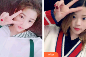 廣州遠東美容醫(yī)院黃履攸整形價格表附冷光美白案例展示